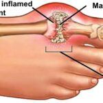 Stop refrigerating these 10 condiments