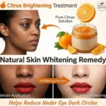 The effective home remedy against aphids used by gardeners: You have it in the kitchen