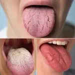Taro Root: The Ancient Superfood Transforming Health and Sustainability